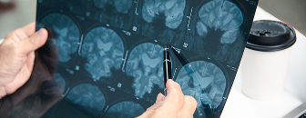 brain injuries