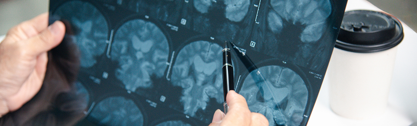 traumatic brain injury