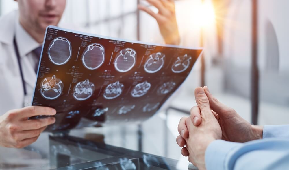Brain Injury After a Car Accident in Oklahoma City